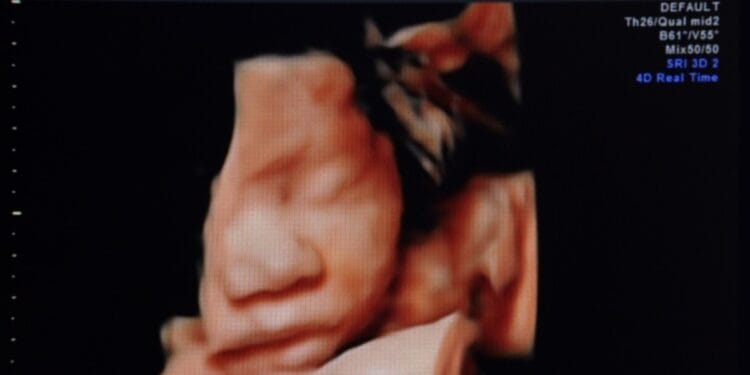 Fetal mind surgical procedure, and a White Home AI summit